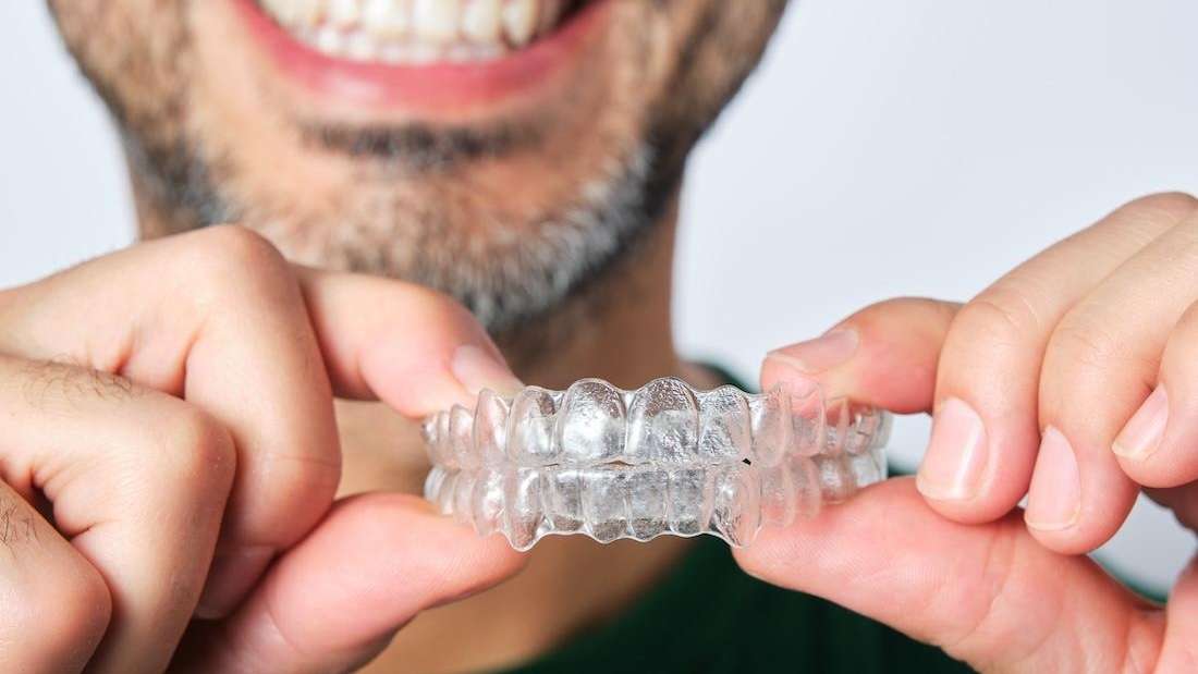 Maintaining Your New Smile After Invisalign: Post-Treatment Tips for Elk  Grove Residents
